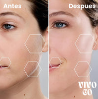 Vellora™  Depiladora Facial